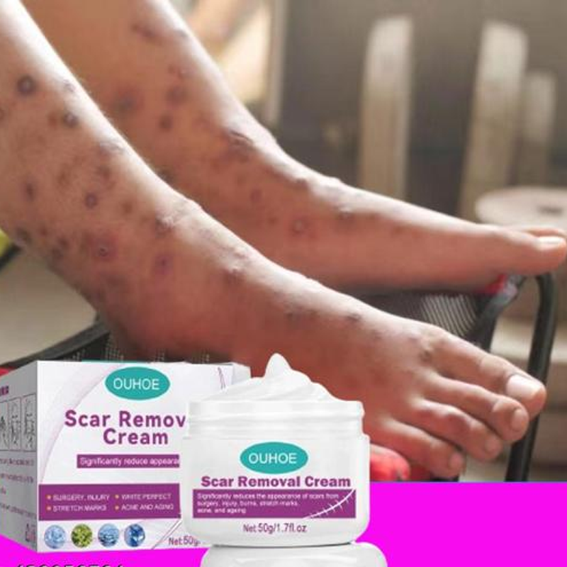 Scar  Removal Cream