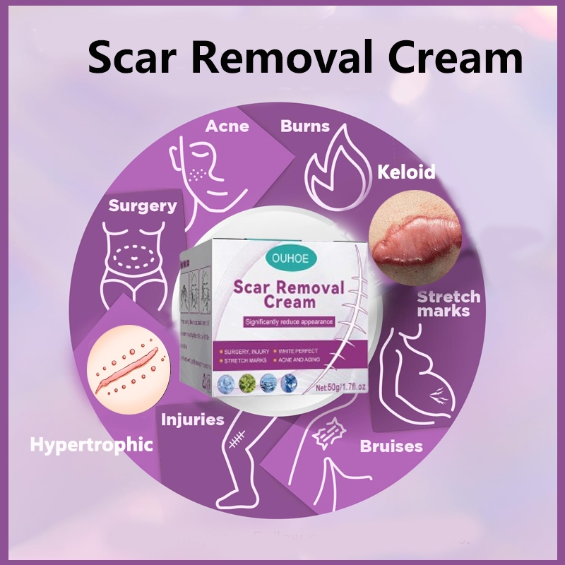 Scar  Removal Cream