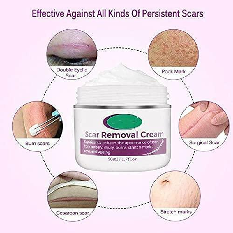 Scar  Removal Cream