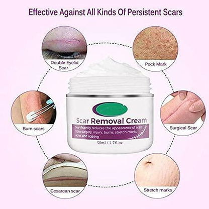 Scar  Removal Cream