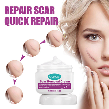 Scar Removal Cream