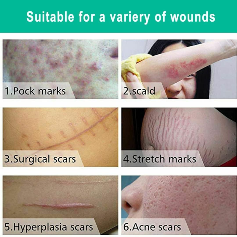 Scar Removal Cream