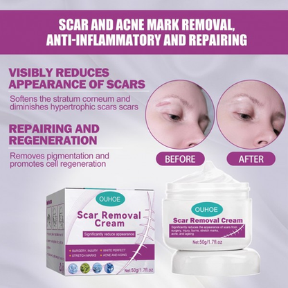 Scar Removal Cream