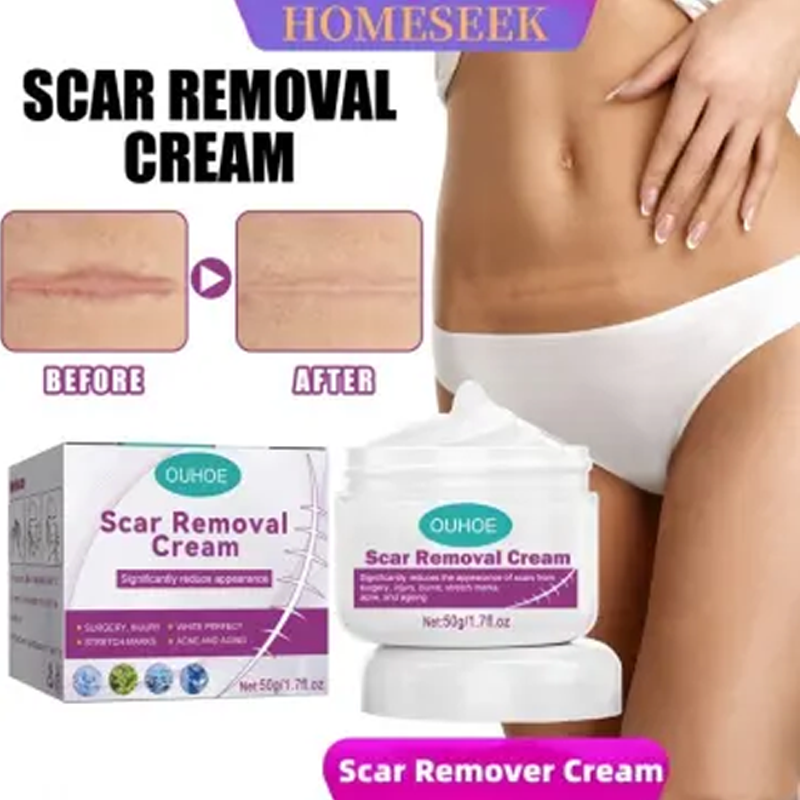 Scar Removal Cream
