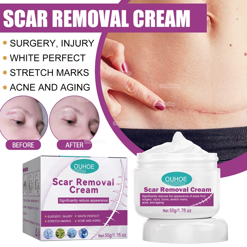 Scar Removal Cream